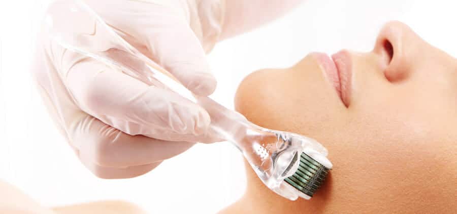 skin-needling-bournemouth-Dermarolling
