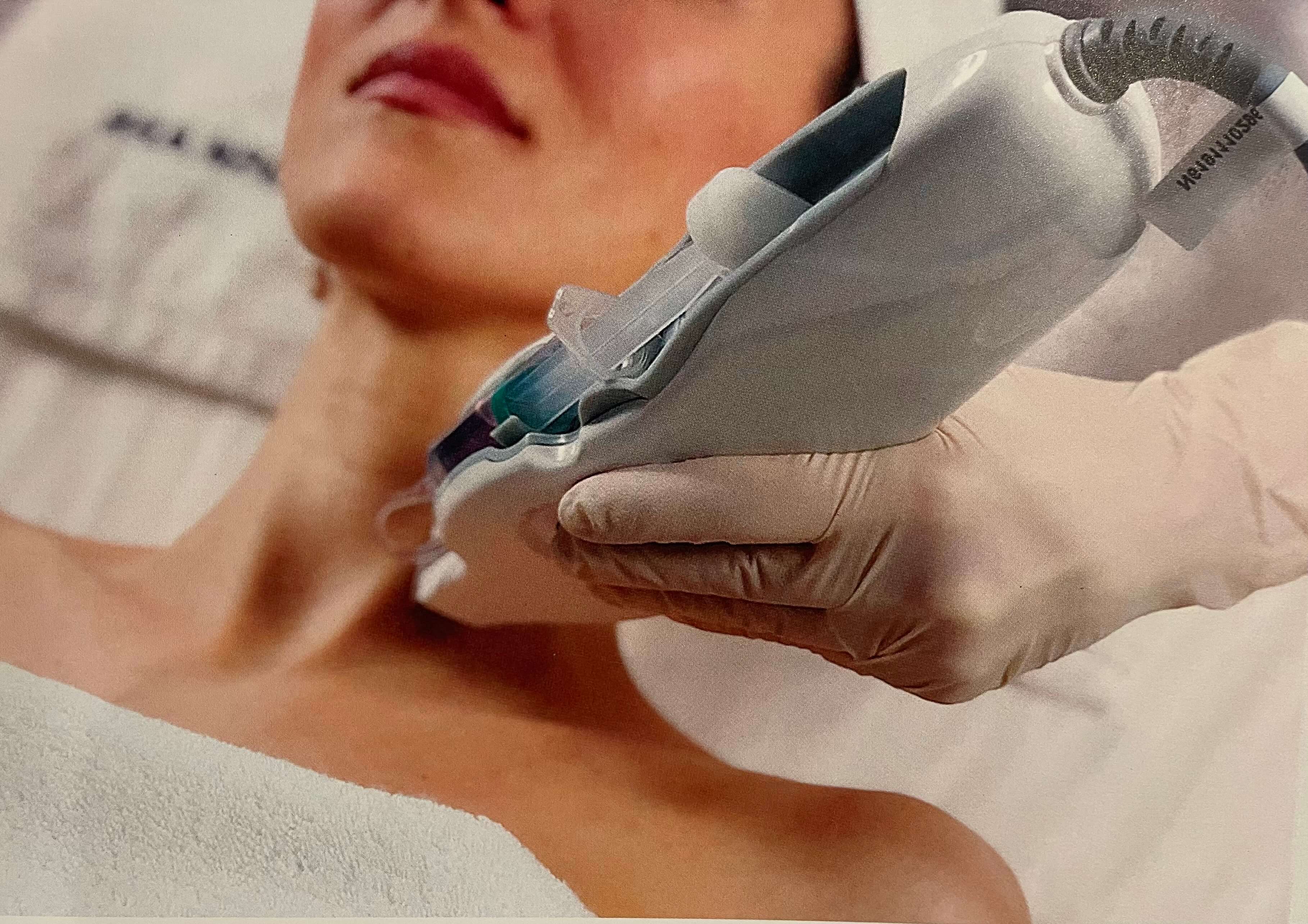TKN Mesoject Gun Needle-Free Mesotherapy London | Harley Street Skin Rejuvenation